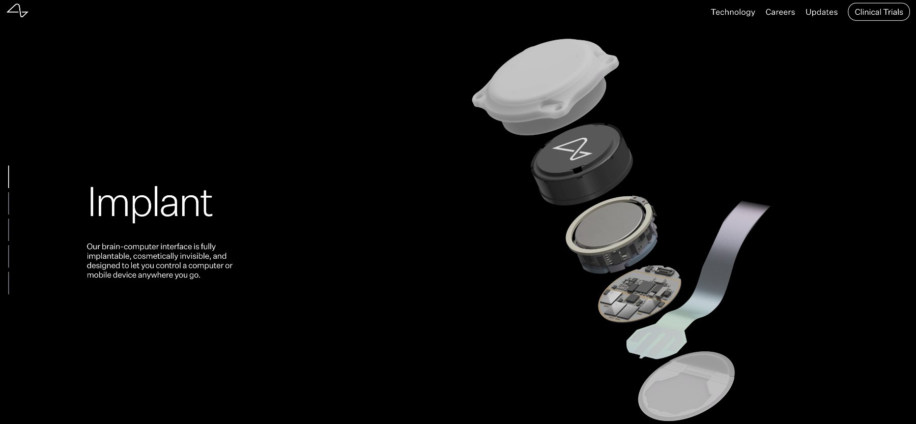 Website image explains the brain implant